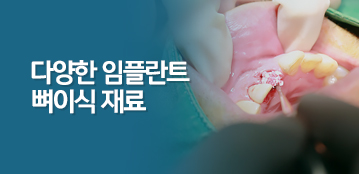 디지털치과 소식 썸네일
