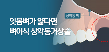 디지털치과 소식 썸네일
